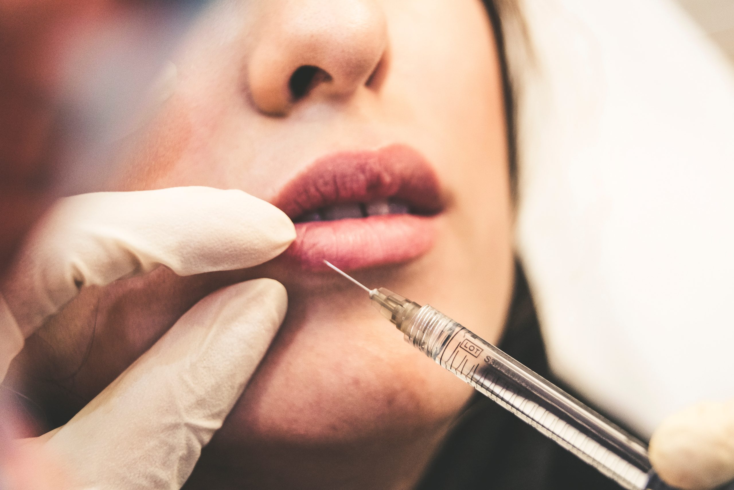 How to Find the Best Botox in LOS ANGELES!