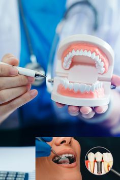 Nhs Dentists in St Helens: Your Guide to Affordable Dental Care