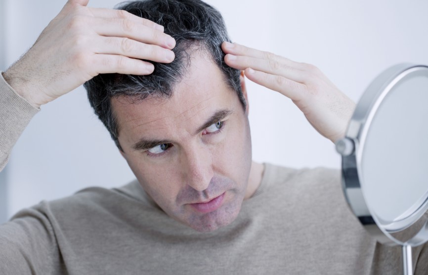 Tips to Prevent Hair Loss in Men in 2023