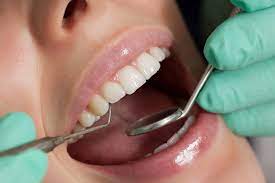Achieve a Healthy Smile with Teeth Cleaning Dentist Dumfries